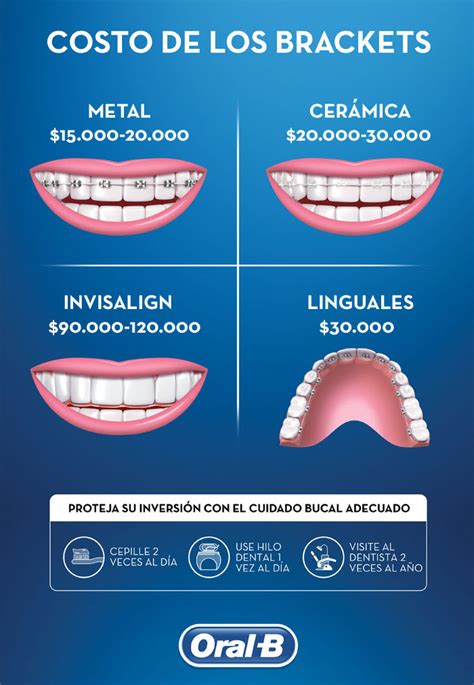 precios de brackets metalicos|cuanto cuesta un bracket.